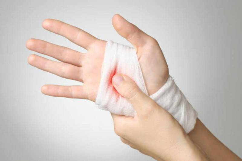 Mơ thấy bàn tay bị đứt